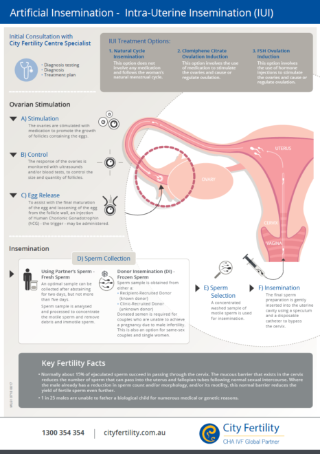 Insemination Pregnant Before After