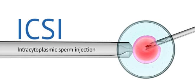 ICSI