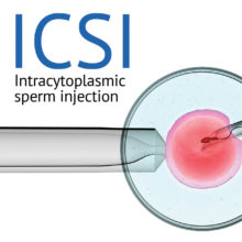 Image of ICSI intracytoplasmic sperm injection
