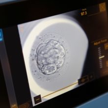 City Fertility Brisbane City - EmbryoScope Timelapse Incubator
