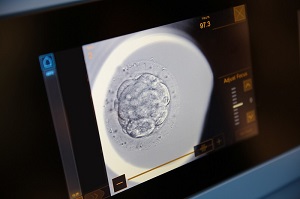 Embryoscope IVF technology