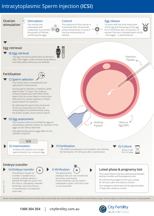sperm injection home kit