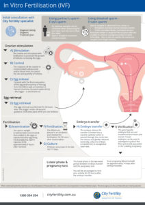 IVF infographic City Fertility