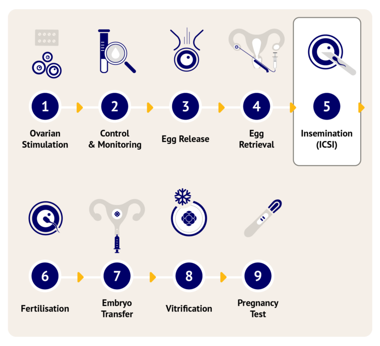 ICSI | IVF Fertility Treatment